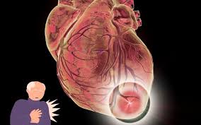 Кардиология